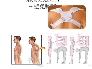 解決方法 (二)
-- 避免駝背
2015/2/9 29
 