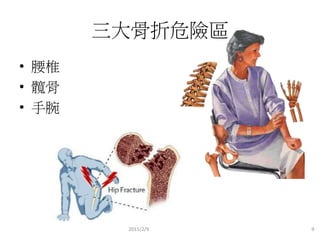 三大骨折危險區
• 腰椎
• 髖骨
• 手腕
2015/2/9 9
 
