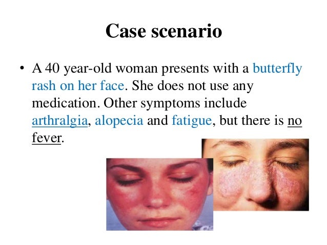 Pictures of facial lupus rash