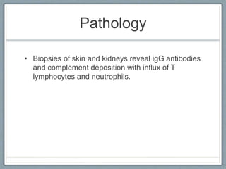 Systemic Lupus Erythematosus by Dr. Daniel B. Yidana | PPTX