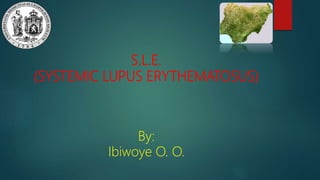 S.L.E.
(SYSTEMIC LUPUS ERYTHEMATOSUS)
By:
Ibiwoye O. O.
 