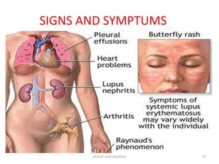 SIGNS AND SYMPTUMS
jamilah saad alqahtani 13
 