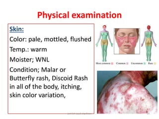 Physical examination
Skin:
Color: pale, mottled, flushed
Temp.: warm
Moister; WNL
Condition; Malar or
Butterfly rash, Discoid Rash
in all of the body, itching,
skin color variation,
jamilah saad alqahtani 19
 