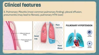 5. Pulmonary: Pleuritis (most common pulmonary finding), pleural effusion,
pneumonitis (may lead to fibrosis), pulmonary HTN (rare)
Clinical features
 