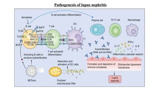 Pathogenesis of lupus nephritis
 