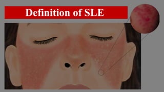 Definition of SLE
 
