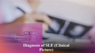 Diagnosis of SLE (Clinical
Picture)
 