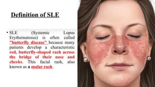 Definition of SLE
• SLE (Systemic Lupus
Erythematosus) is often called
"butterfly disease" because many
patients develop a characteristic
red, butterfly-shaped rash across
the bridge of their nose and
cheeks. This facial rash, also
known as a malar rash.
 