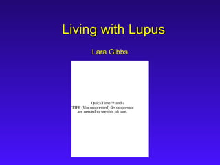 Living with LupusLiving with Lupus
Lara GibbsLara Gibbs
QuickTime™ and a
TIFF (Uncompressed) decompressor
are needed to see this picture.
 