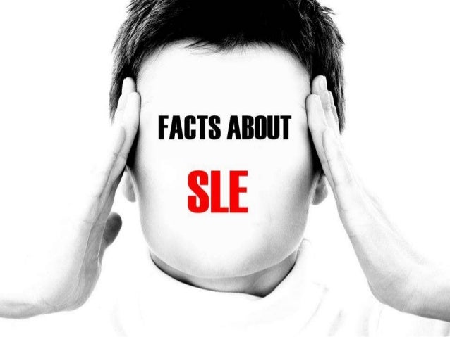 Treatments For SLE (Systemic Lupus Erythematosus) - Doctor Answers