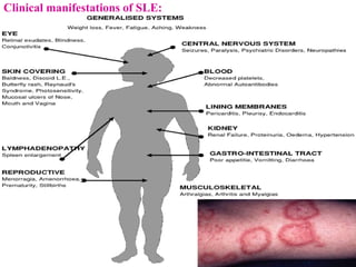 Clinical manifestations of SLE:
 