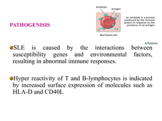 PATHOGENISIS
SLE is caused by the interactions between
susceptibility genes and environmental factors,
resulting in abnormal immune responses.
Hyper reactivity of T and B-lymphocytes is indicated
by increased surface expression of molecules such as
HLA-D and CD40L
 