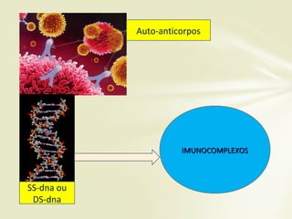 Auto-anticorpos
SS-dna ou
DS-dna
IMUNOCOMPLEXOSIMUNOCOMPLEXOS
 