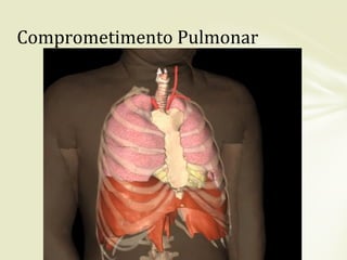 Comprometimento Pulmonar
 