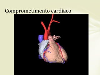 Comprometimento cardíaco
 
