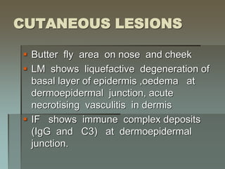 CUTANEOUS LESIONS
 Butter fly area on nose and cheek
 LM shows liquefactive degeneration of
basal layer of epidermis ,oedema at
dermoepidermal junction, acute
necrotising vasculitis in dermis
 IF shows immune complex deposits
(IgG and C3) at dermoepidermal
junction.
 