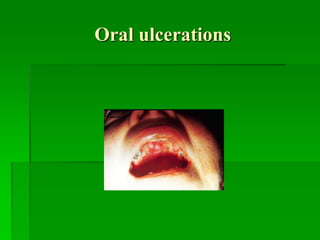 Oral ulcerations
 