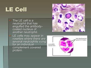 LE Cell
 The LE cell is a
neutrophil that has
engulfed the antibody-
coated nucleus of
another neutrophil.
 LE cells may appear in
rosettes where there are
several neutrophils vying
for an individual
complement covered
protein.
 