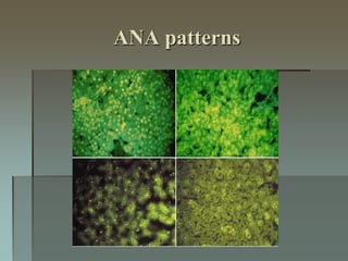 ANA patterns
 
