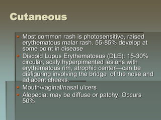 Cutaneous
 Most common rash is photosensitive, raised
erythematous malar rash. 55-85% develop at
some point in disease
 Discoid Lupus Erythematosus (DLE): 15-30%
circular, scaly hyperpimented lesions with
erythematous rim, atrophic center—can be
disfiguring involving the bridge of the nose and
adjacent cheeks.
 Mouth/vaginal/nasal ulcers
 Alopecia: may be diffuse or patchy. Occurs
50%
 