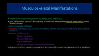 Musculoskeletal Manifestations
 Intermittent Polyarthritis ( commonly Hands, Wrist and Knees)
Joint deformities( Jaccoud’s Arthropathy in hands and feet) develop in only 10% patients due to
Tendon damage.
Joint erosions do not occur.
RHUPUS: Individuals may have rheumatoid like arthritis with erosion and fulfill criteria for both
RA and SLE.
Myositis: Evidenced by
Muscle weakness
Elevated CPK level
Positive MRI scan
Muscle necrosis and inflammation on biopsy
Glucocorticoid therapies (commonly) and Antimalarial therapies (rarely) cause muscle weakness.
 