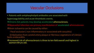 Vascular Occlusions
• Patients with antiphospholipid antibodies are associated with
hypercoagulability and acute thrombotic events.
Chronic SLE patients may develop accelerated atherosclerosis.
Myocardial Infarction are primary manifestation of accelerated atherosclerosis
Brain ischaemia can be caused by either:
- Focal occlusion ( non inflammatory or associated with vasculitis)
-Embolization from carotid artery plaque or fibrinous vegetations of Libman-
Sacks endocarditis.
Increased risk of atherosclerosis is three to ten fold overall and highest in
women<49 yrs old.
 