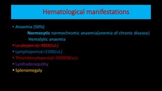 Hematological manifestations
• Anaemia (50%)
Normocytic normochromic anaemia(anemia of chronic disease)
Hemolytic anaemia
 Leukopenia(<4000/uL)
 Lymphopenia(<1500/uL)
 Thrombocytopenia(<100000/uL)
 Lymhadenopathy
 Splenomegaly
 