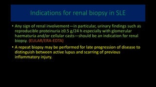 Indications for renal biopsy in SLE
• Any sign of renal involvement—in particular, urinary findings such as
reproducible proteinuria ≥0.5 g/24 h especially with glomerular
haematuria and/or cellular casts—should be an indication for renal
biopsy. (EULAR/ERA-EDTA)
• A repeat biopsy may be performed for late progression of disease to
distinguish between active lupus and scarring of previous
inflammatory injury.
 
