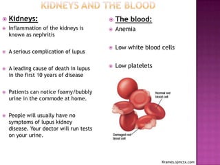  Kidneys:
 Inflammation of the kidneys is
known as nephritis
 A serious complication of lupus
 A leading cause of death in lupus
in the first 10 years of disease
 Patients can notice foamy/bubbly
urine in the commode at home.
 People will usually have no
symptoms of lupus kidney
disease. Your doctor will run tests
on your urine.
 The blood:
 Anemia
 Low white blood cells
 Low platelets
Krames.sjmctx.com
 