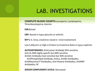 Sle by dr qudsia | PPT