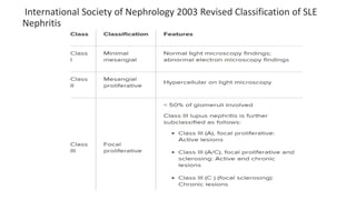 International Society of Nephrology 2003 Revised Classification of SLE
Nephritis
 