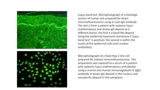 Lupus band test. Microphotograph of a histologic
section of human skin prepared for direct
immunofluorescence using an anti-IgG antibody.
The skin is from a patient with systemic lupus
erythematosus and shows IgG deposit at 2
different places: the first is a band-like deposit
along the epidermal basement membrane ("lupus
band test" is positive); the second is within the
nuclei of the epidermal cells (anti-nuclear
antibodies).
Microphotograph of a fixed Hep-2 line cell
prepared for indirect immunofluorescence. The
preparation was exposed to a serum of a patient
with systemic lupus erythematosus and labeled
using a murine anti-human immunoglobulin G (IgG)
antibody. It shows IgG deposit in the nucleus and
nonspecific deposit in the cytoplasm.
 