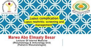 Marwa Abo Elmaaty Besar
Lecturer Of Internal Medicine
(Rheumatology & immunology Unit)
(Pediatric Rheumatologist)
Lupus complication
Lupus nephritis; screening and
management.
 