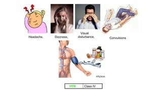 Visual
disturbance, Convulsions
Dizzness,
Headache,
Class IV
HTN
 