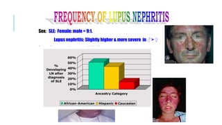 Sex: SLE: Female: male = 9:1.
Lupus nephritis: Slightly higher & more severe in ♂ > ♀
Age: Common in pts aged 20-40 yrs
Race: Higher, more severe in Black and Asian people.
 