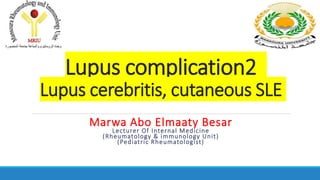 Lupus complication2
Lupus cerebritis, cutaneous SLE
Marwa Abo Elmaaty Besar
Lecturer Of Internal Medicine
(Rheumatology & immunology Unit)
(Pediatric Rheumatologist)
 
