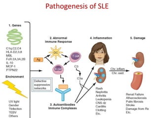 Pathogenesis of SLE
 