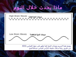 ماذا يحدث خلال النوم موجات المخ العالية موجات المخ المنخفضة يوضح هذا الرسم موجات المخ كما تظهر في جهاز القياس  EEG   عن طريق ربط أسلاك دقيقة بالرأس لقياس نشاط المخ 