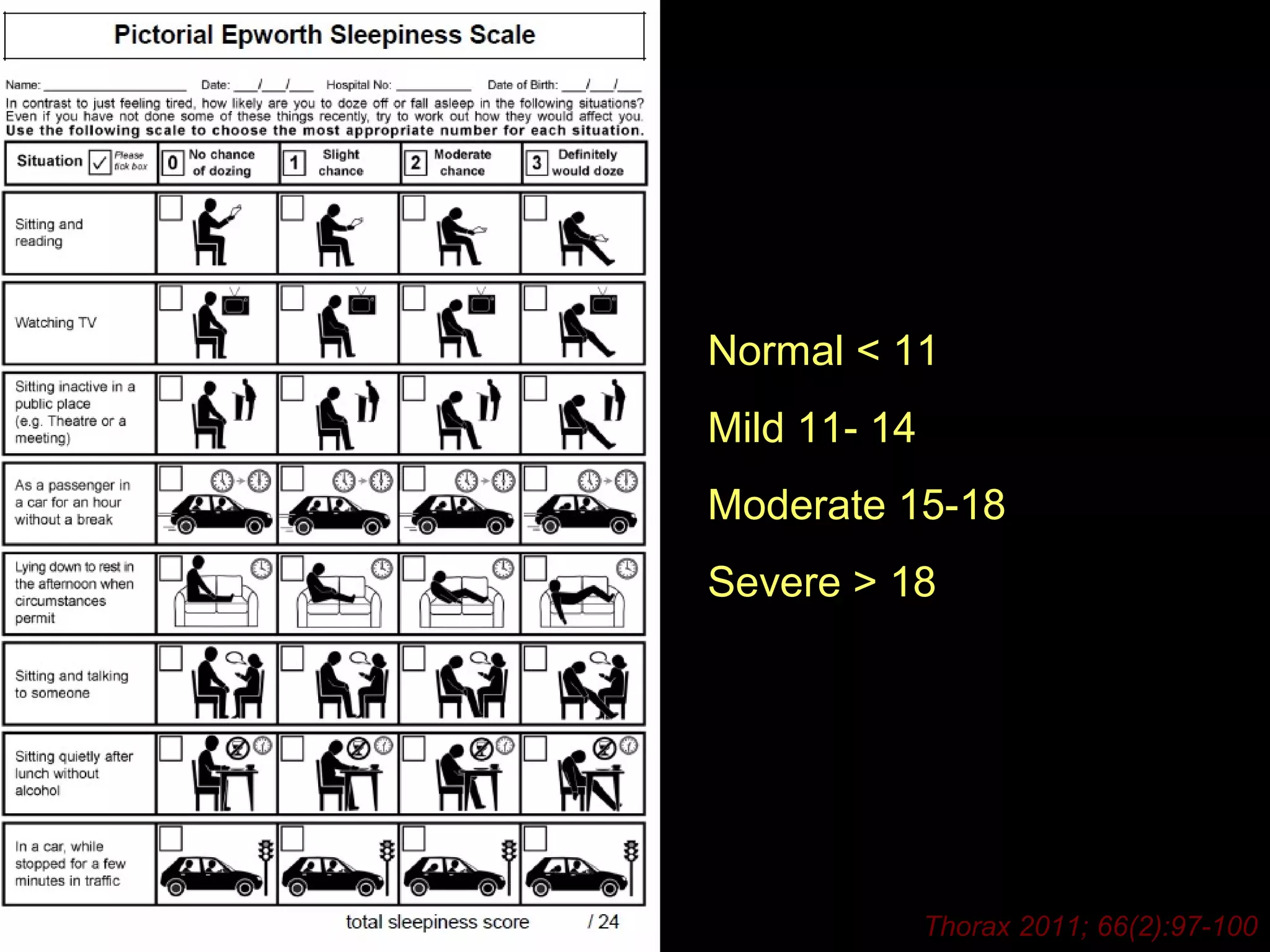 Normal < 11 
Mild 11- 14 
Moderate 15-18 
Severe > 18 
Thorax 2011; 66(2):97-100 
 