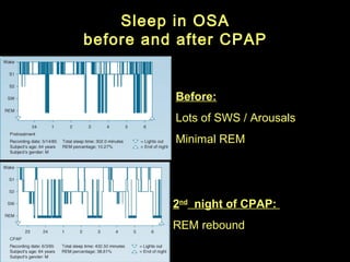 Sleep Study Interpretation | PPT