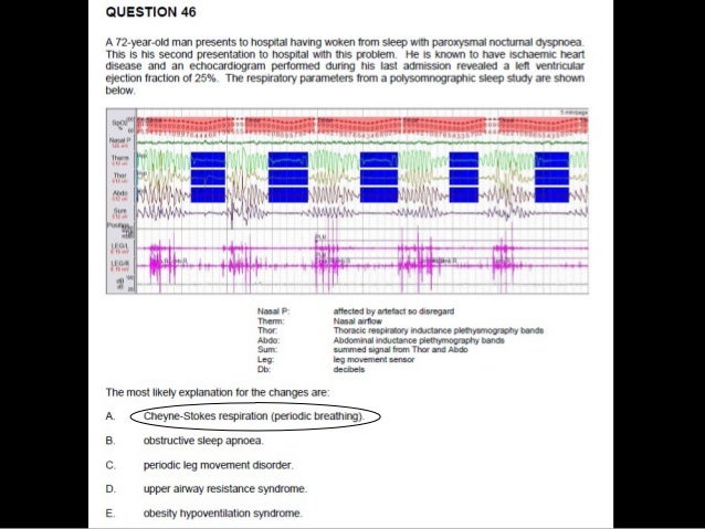 Sleep Study Interpretation