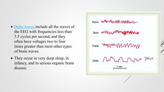 Delta Waves Example Sleep.pptx