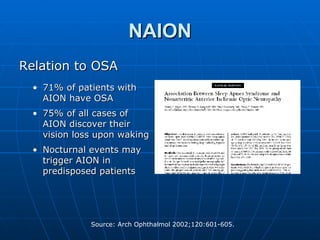 NAION Relation to OSA 71% of patients with AION have OSA 75% of all cases of AION discover their vision loss upon waking Nocturnal events may trigger AION in predisposed patients 