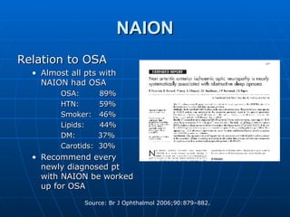NAION Relation to OSA Almost all pts with NAION had OSA OSA:  89% HTN:  59% Smoker:  46% Lipids:  44% DM:  37% Carotids:  30% Recommend every newly diagnosed pt with NAION be worked up for OSA 