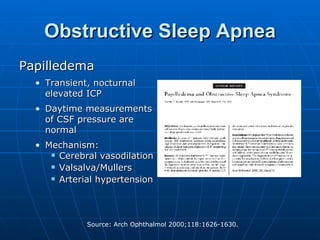Obstructive Sleep Apnea Papilledema Transient, nocturnal elevated ICP  Daytime measurements of CSF pressure are normal Mechanism: Cerebral vasodilation Valsalva/Mullers Arterial hypertension 