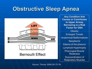 Obstructive Sleep Apnea Any Condition that Causes or Contributes to Upper Airway Narrowing is a Risk Factor for OSA Obesity Enlarged Tonsils Anatomical Malformations Neoplasms Edema of the pharynx Lymphoid Hypertrophy Pharyngeal Muscle Weakness Dyscoordination of Respiratory Muscles 