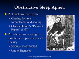 Obstructive Sleep Apnea Pickwickian Syndrome Obesity, daytime somnolence, loud snoring Charles Dicken’s “Pickwick Papers” (1837) Prevalence increasing in parallel with prevalence of obesity 30-60yo: 9%F, 24%M Under-diagnosed 