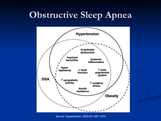 Obstructive Sleep Apnea 