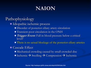NAION Pathophysiology Idiopathic ischemic process  Disorder of posterior ciliary artery circulation Transient poor circulation in the ONH Trigger Event : Fall in blood pressure below a critical level? There is no actual blockage of the posterior ciliary arteries Cascade Effect Mechanical crowding caused by small crowded disc Ischemia    Swelling    Compression    Ischemia 