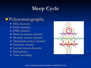 Sleep Cycle Polysomnography EEG channels  EOG channels  EMG channel Nasal air current channel  Thoracic motion channel  Abdominal motion channel Oximeter channel Leg movement channels Microphone Video recording 